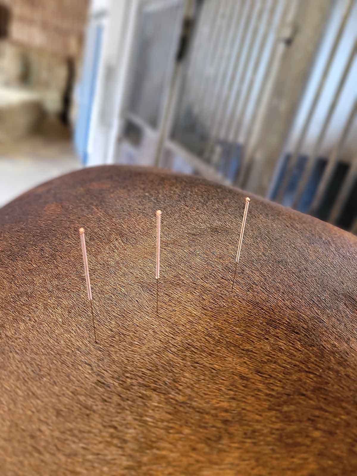 Dry Needling Julia Kruse Dry Needling Julia Kruse