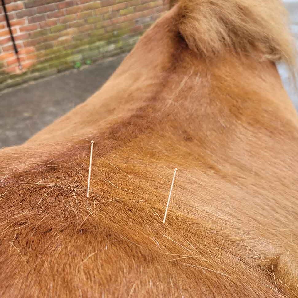 Dry Needling Julia Kruse Dry Needling Julia Kruse